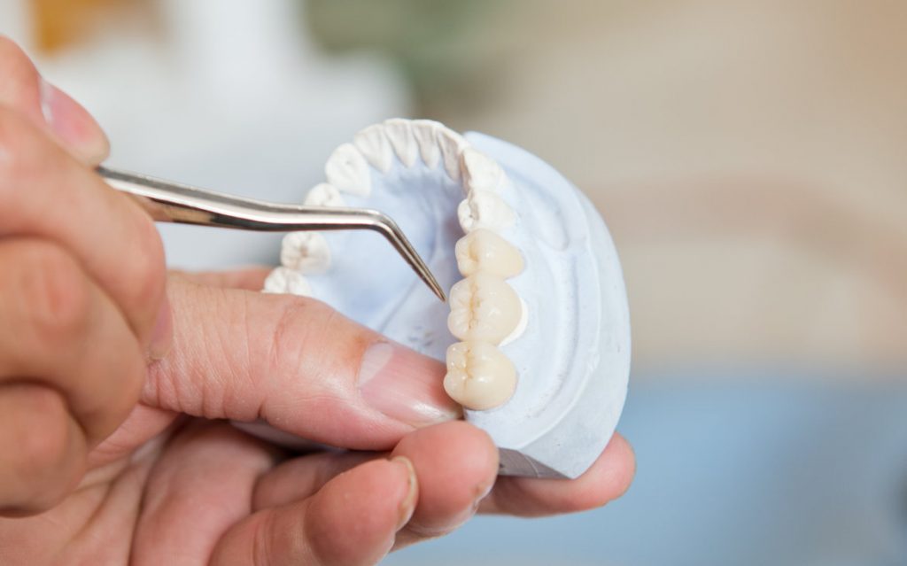  Full set of dentures            